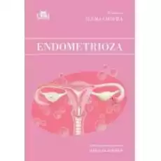 Endometrioza Książki Nauki ścisłe