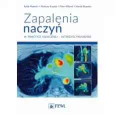 Zapalenia naczyń 8211 w praktyce klinicznej interdyscyplinarnie Książki Nauki ścisłe