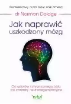 Jak naprawić uszkodzony mózg Od udarów i chronicznego bólu po choroby neurodegeneracyjne Książki Ebooki