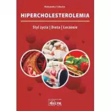 Hipercholesterolemia Książki Poradniki