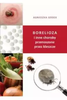 Borelioza i inne choroby przenoszone przez kleszcze Książki Audiobooki