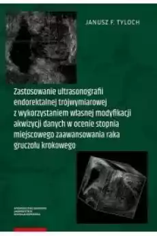 Zastosowanie ultrasonografii endorektalnej trójwymiarowej z wykorzystaniem własnej modyfikacji akwizycji danych w ocenie stopnia Książki Audiobooki