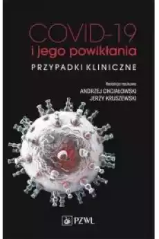 COVID19 i jego powikłania przypadki kliniczne Książki Audiobooki