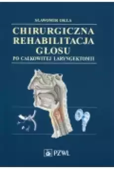 Chirurgiczna rehabilitacja głosu po całkowitej laryngektomii Książki Podręczniki i lektury