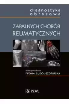 Diagnostyka obrazowa zapalnych chorób reumatycznych Książki Audiobooki