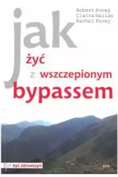 Jak życ z wszczepionym bypassem Książki Zdrowie medycyna