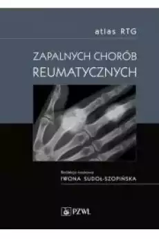 Atlas RTG zapalnych chorób reumatycznych Książki Audiobooki