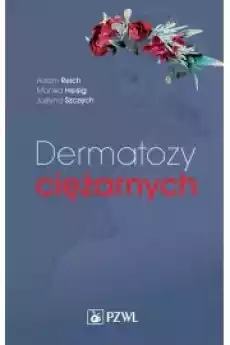 Dermatozy ciężarnych Książki Audiobooki