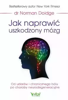 Jak naprawić uszkodzony mózg Książki Zdrowie medycyna