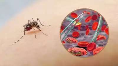 Malaria,Leczenie, choroby odzwierzęce, zakażenia, podróże Groźna choroba będzie niewykrywalna i nieuleczalna. Pasożyt zmutował 